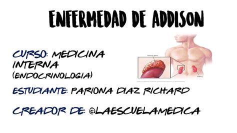 ENFERMEDAD DE ADDISON La Escuela Médica uDocz