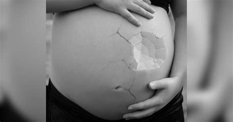 Le Practican Un Aborto Por Error A Una Paciente Embarazada
