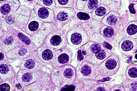 Human Skin Cells Under Microscope