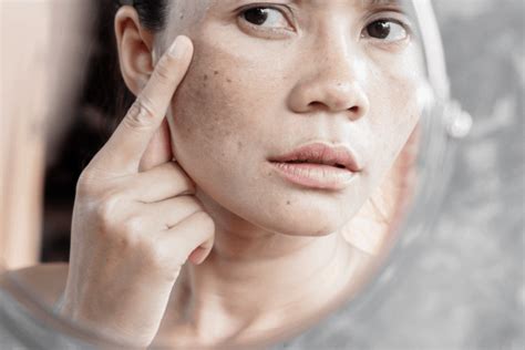 Skin Dehydration Condition Considerations | One Clinic MD