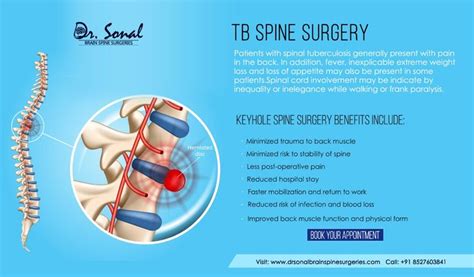 Pin On Tb Spine Surgery