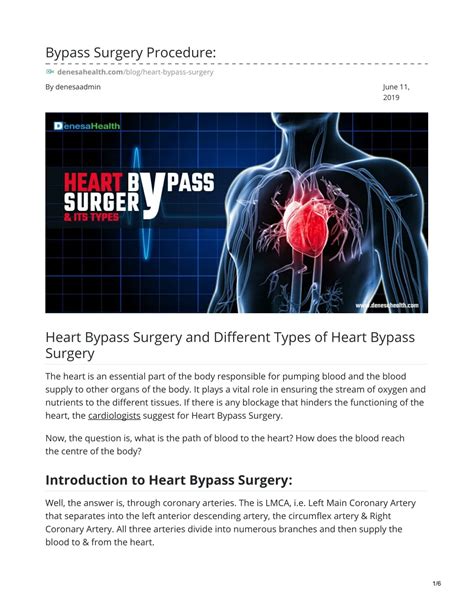 Ppt Heart Bypass Surgery And Different Types Of Heart Bypass Surgery