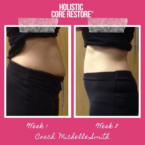 Before And After Diastasis Recti Repair Gallery Holistic Core Restore