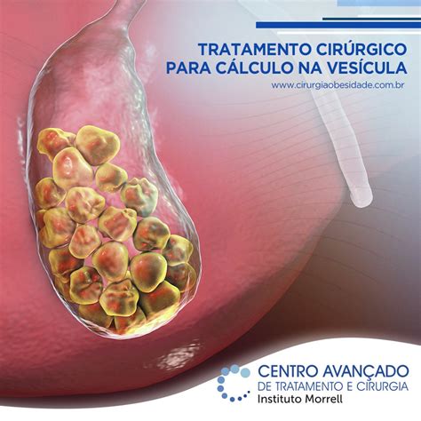 Vesícula Para Que Serve