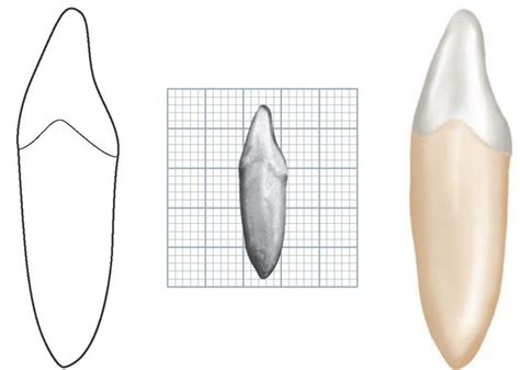 The Permanent Mandibular Incisors Dental Anatomy Physiology And