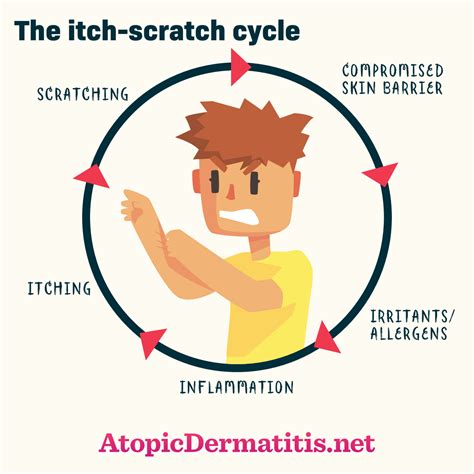 What Is The Itch Scratch Cycle