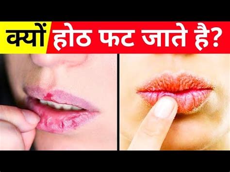 Why Lips Dry And Crack In Winter In Hindi Lipstick Body Care Health YouTube