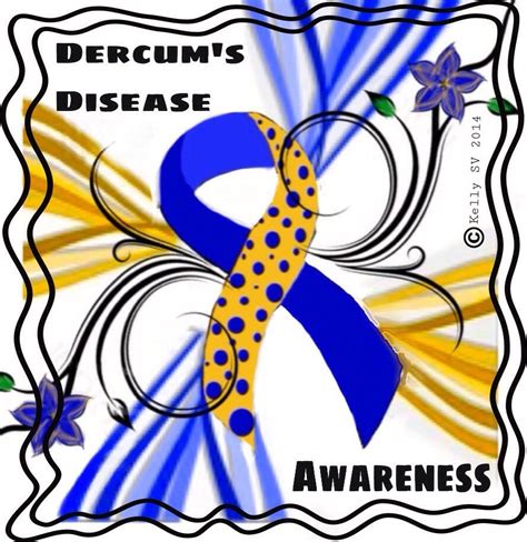 Dercum Dercums Disease Old