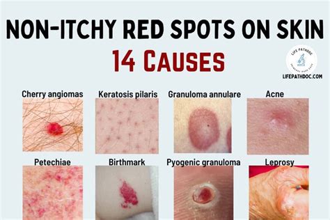 Red Spots On Skin But Not Itchy Causes Pictures Treatment