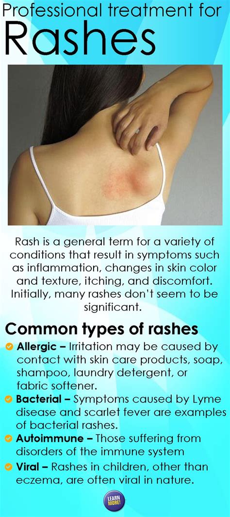 Types Of Rashes Pictures