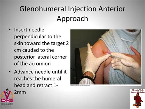 Ppt Shoulder Girdle Joint Injection Workshop Powerpoint Presentation