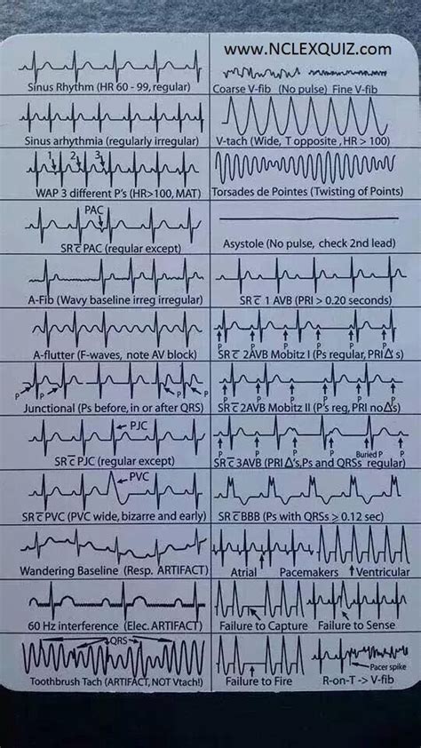 Ekg Heart Rhythms Cheat Sheet Nursing Cardiac Nursing Critical