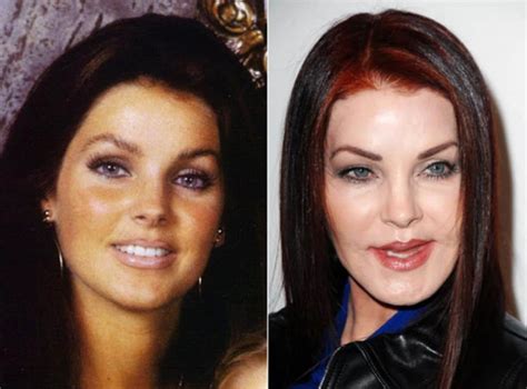 20 Worst Cases Of Celebrity Plastic Surgery Gone Wrong Page 5 Of 5