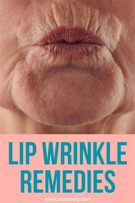 Are You Dealing With Upper Lip Wrinkles You Can Counteract Signs Of
