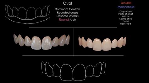 Diseño Digital De La Sonrisa ⋆ Laboratorio Dental Design Disenos De