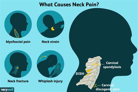 Neck Pain Restoralife Causes And Treatment