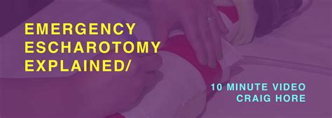 Due to the in these cases it may become necessary to perform and escharotomy to preserve respiratory function. critical Archives - Intensive Care Network