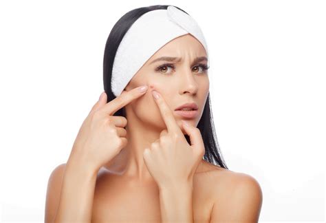 Summer Acne What Is It How To Deal With It Skinglow Clinic