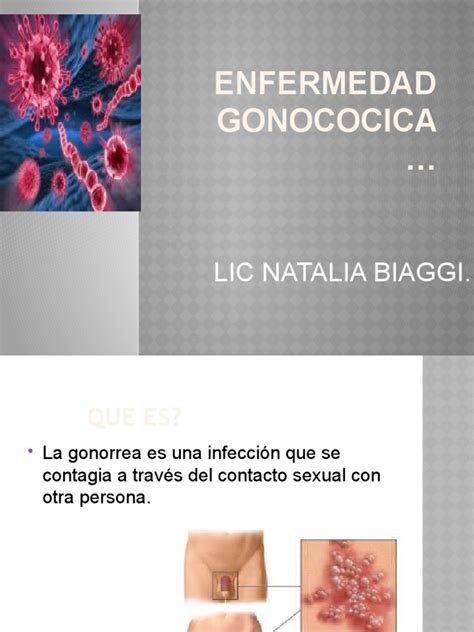 Enfermedad Gonococica Pdf Infección Transmitida Sexualmente