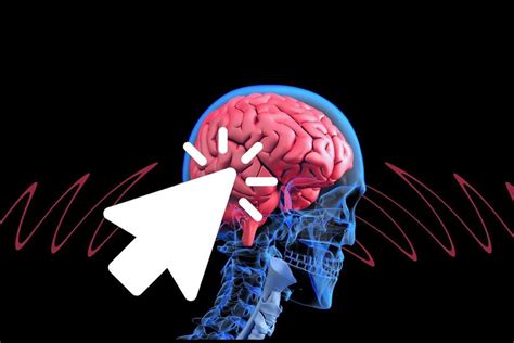 Ntecedentes y concepto actual de isquemia cerebral transitoria. Causas de Hipotiroidismo |Dr. Francisco Belda Maruenda