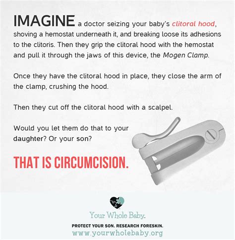 Loose Circumcision Baby