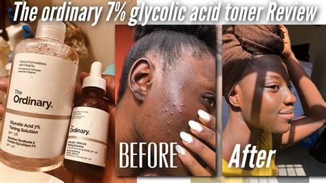 The Ordinary Glycolic Acid 7 Toning Solution Indepth Review Youtube