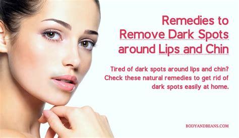 19 Tips And Remedies To Remove Dark Spots Around Lips And Chin Easily