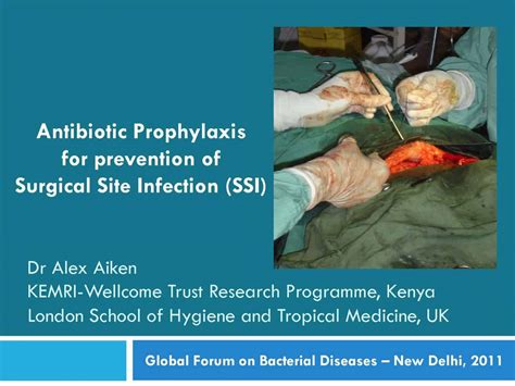 Antibiotic Prophylaxis For Prevention Of Surgical Site