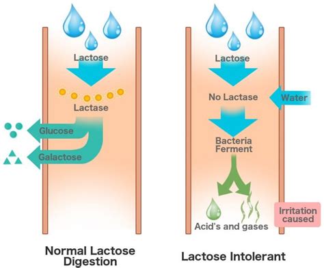 What Is Lactose Intolerance What Are Its Causes Symptoms And Signs