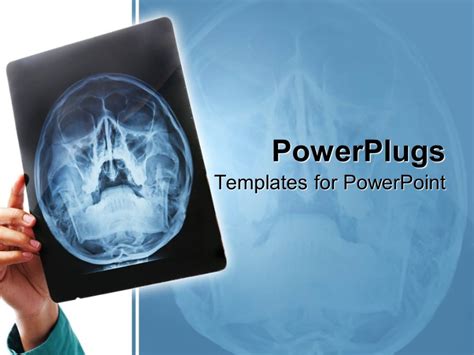 Radiology Powerpoint Templates X Ray Powerpoint Template Mandegar