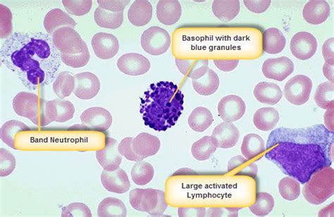 Normal White Blood Cells On A Smear Medical Laboratories