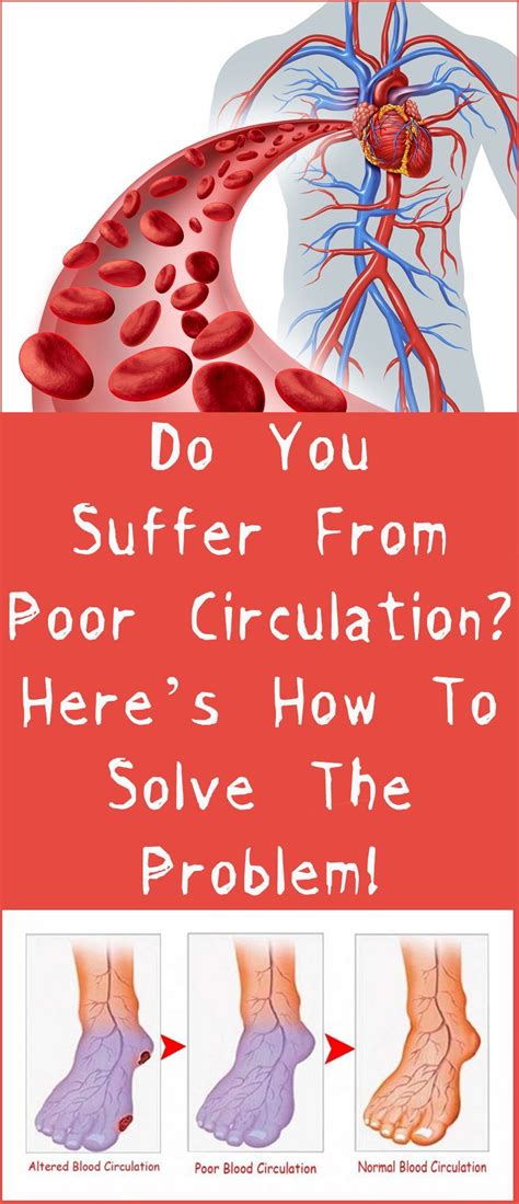 Do You Suffer From Poor Circulation Heres How To Solve The Problem