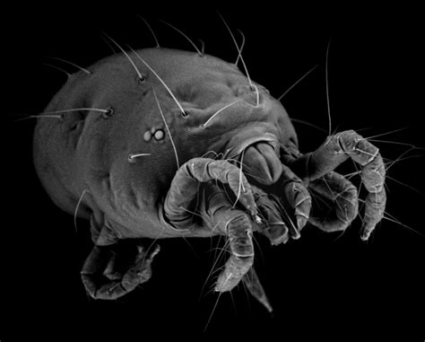 44 Electron Microscope Images That Bring The Invisible To Life