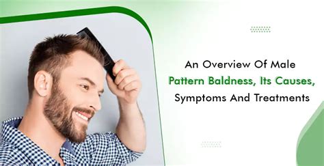 Male Pattern Baldness Causes Symptoms Treatments