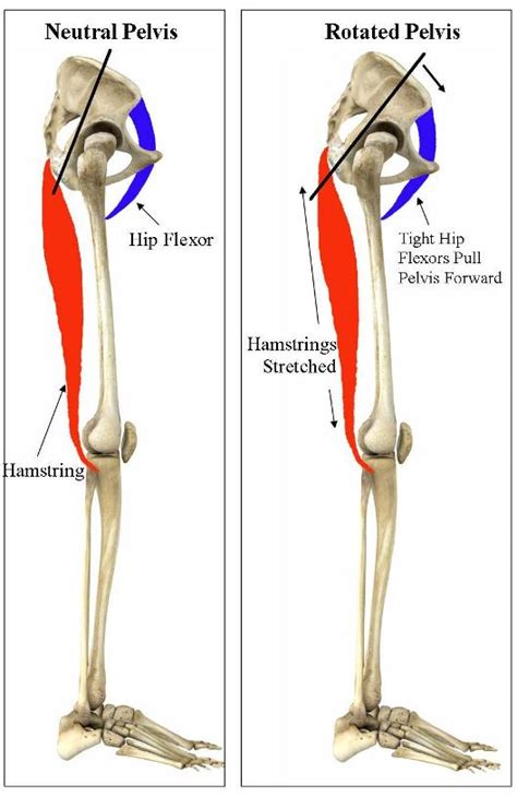 Stop Stretching Tight Hamstrings