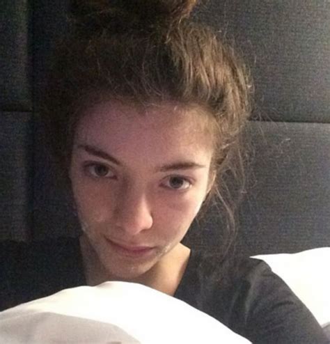 Lorde Shares Photo Of Her Face Covered In Acne Cream Daily Mail Online