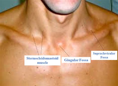 Anatomy Shoulder And Upper Limb Supraclavicular Fossa Article