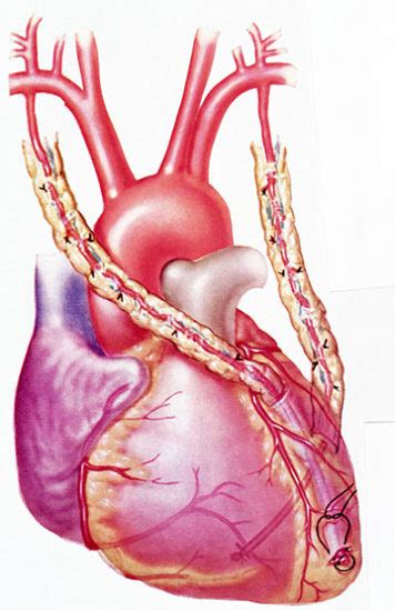 Coronary Artery Bypass Surgery Cardiology Specialists