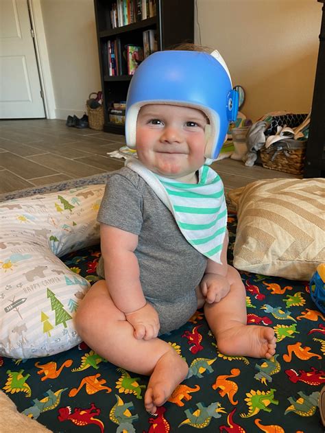 Why Do Infants Need To Wear Helmets For The Greater Column Photographs