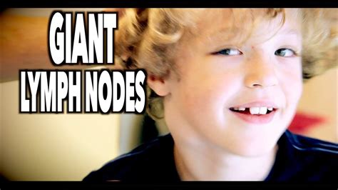 Giant Lymph Nodes Sore Throat And 1 Really Cute Kid Dr Paul Youtube