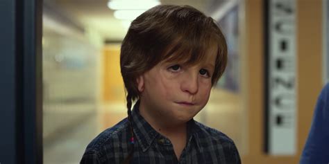 Wonder is the film adaptation of the novel of the same name by r.j. Wonder: Jacob Tremblay On His Prosthetic | Screen Rant