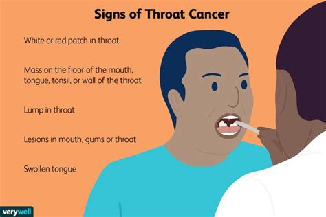 Throat Cancer Pictures Signs Symptoms And Causes