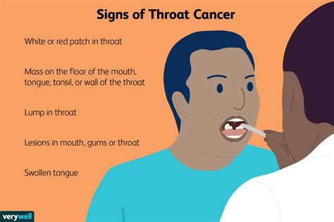 throat cancer pictures signs symptoms and causes