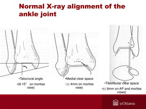 Ppt Foot And Ankle Anatomy And Biomechanics Powerpoint Presentation