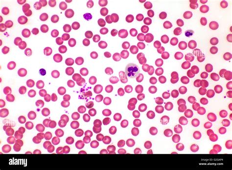 Healthy Human Red And White Blood Cells Brightfield Photomicrograph