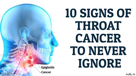 10 Signs Of Throat Cancer To Never Ignore Youtube