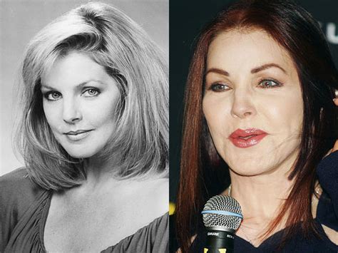 Priscilla Presley Celebrity Plastic Surgery Disasters Pictures Cbs News