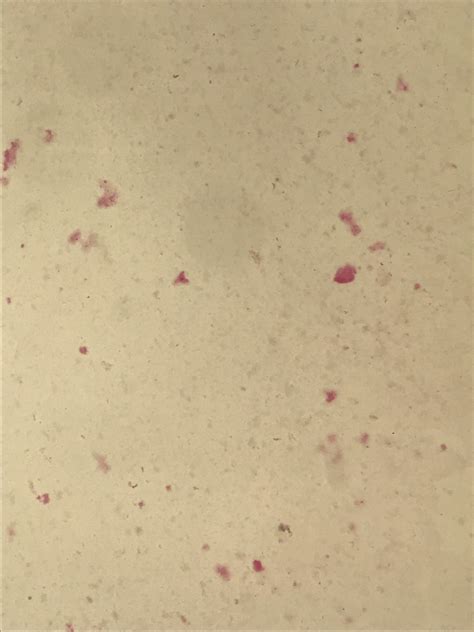 Various strains isolated in blood, abscesses or wounds. Mycoplasma hominis〔なにこれ見えない〕 | グラム染色: Gram Stain