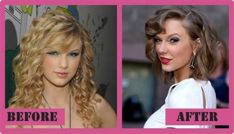 Taylor Swift Plastic Surgery Rumors Were Never Confirmed