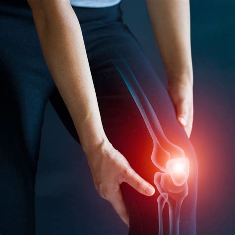 Kneecap Bursitis Orthopedics Sports Medicine